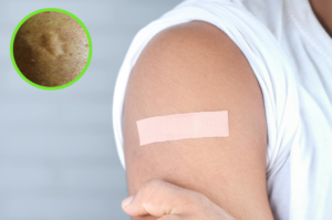 Ever Wonder Why Some People Have That Scar On Their Upper Left Arm? Here’s Why 